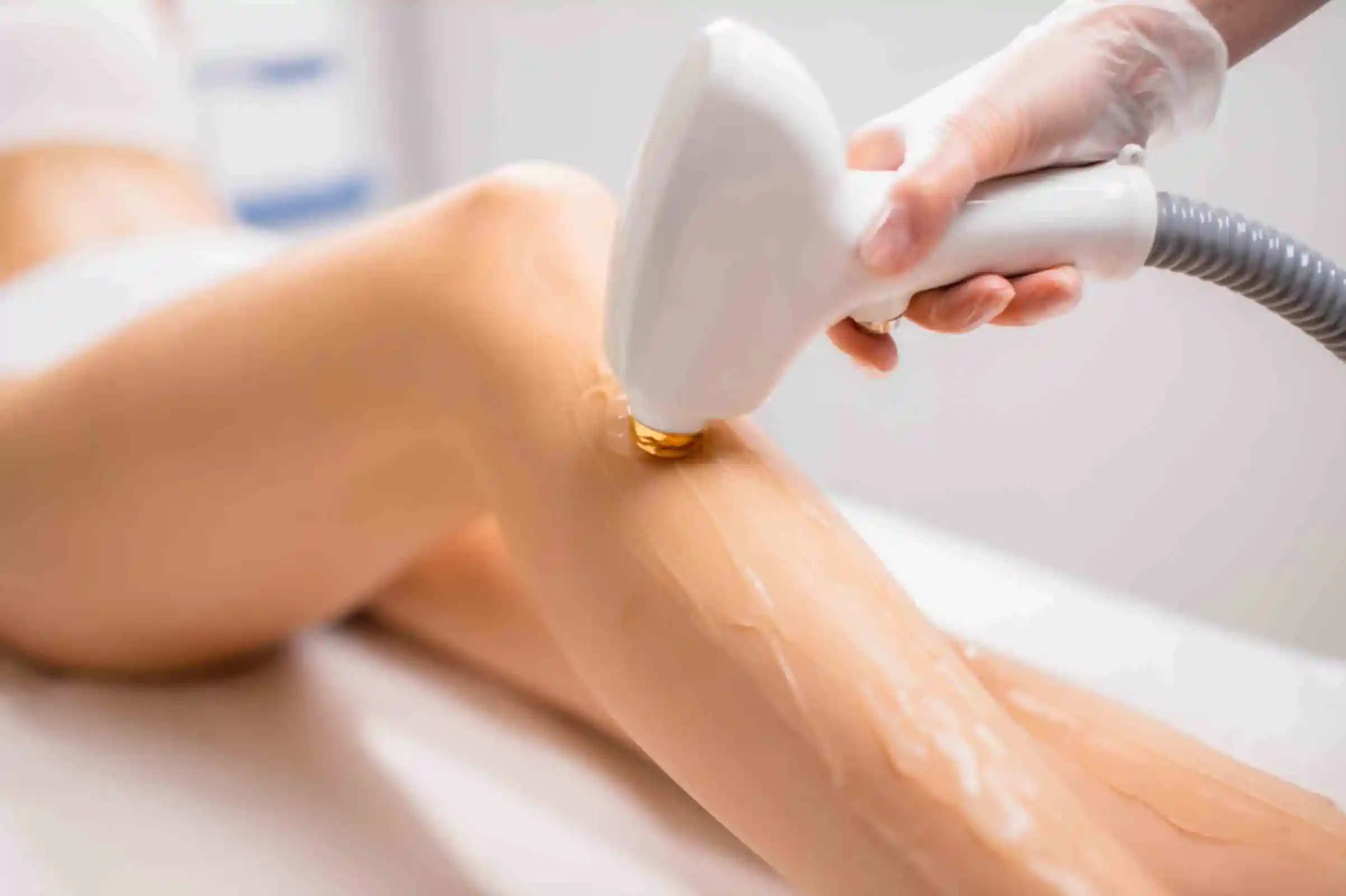 Laser Hair Reduction Rejuve